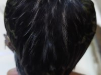 Kara Elmas siyah zeytin Kanarya